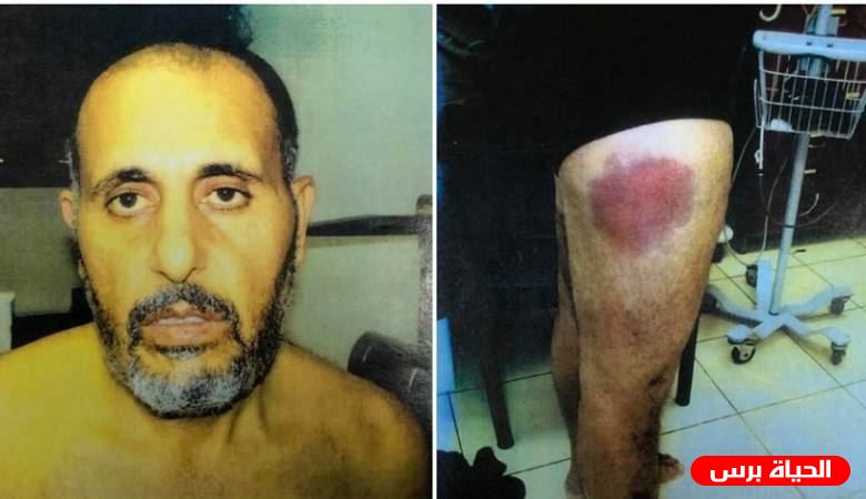 عائلة الأسير حناتشة: صور التعذيب سترفع للجنايات الدولية لأنها جريمة