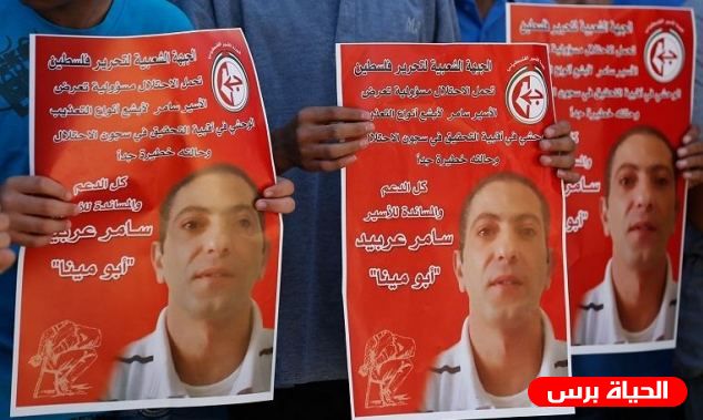 الأسير سامر عربيد لا يزال يعاني من آثار التعذيب القاسي