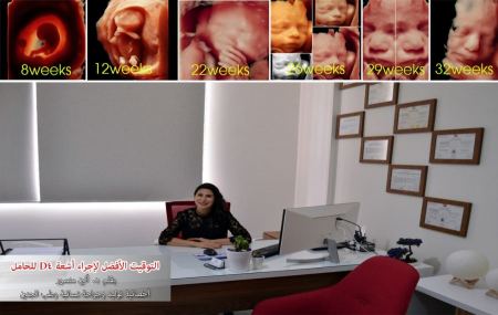 التوقيت الأفضل لإجراء أشعة D4 للحامل