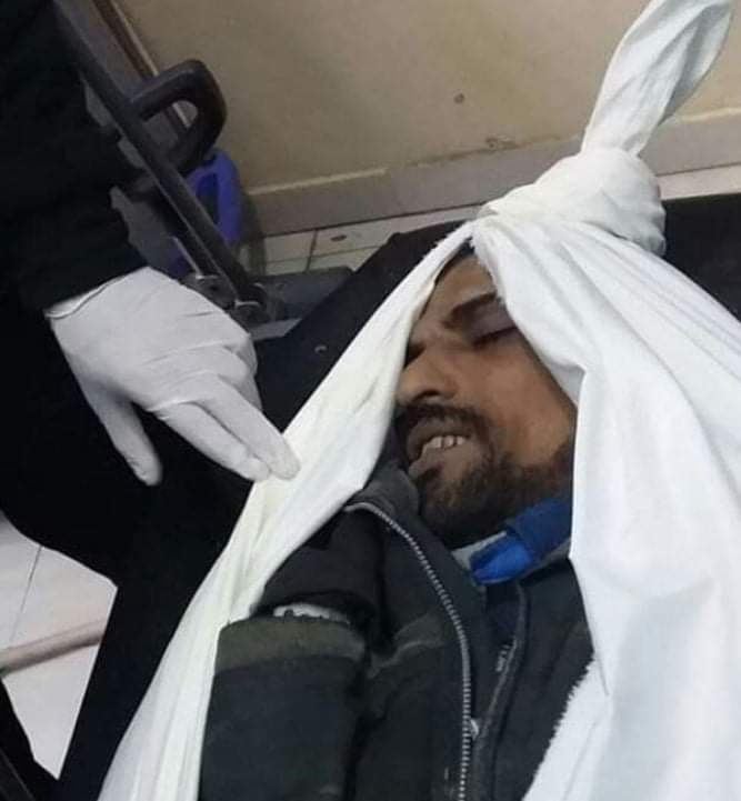 وفاة عامل مصري خلال عمله في قطاع غزة 