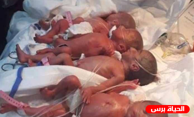 وفاة 6 توائم بعد أيام من الولادة