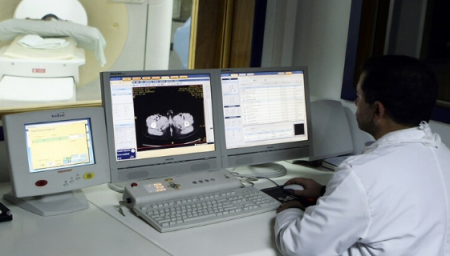 استئصال جنين من بطن طفل عمره 7 سنوات