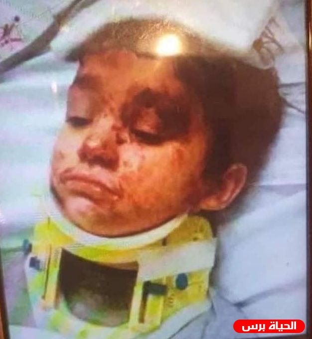 المغرب: توفي ريان وهو يبكي وحيدا 