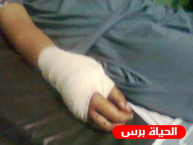 زوجته أجبرته على قطع أوتار يده
