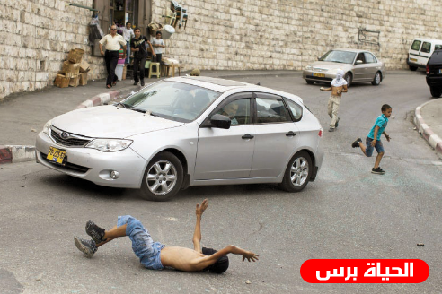 مستوطن يدهس طفلا ويصيبه بجروح في رأسه 