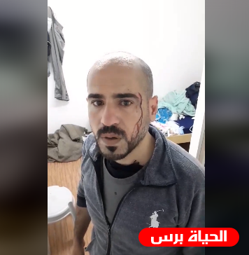 بالفيديو .. تعرض مواطن للضرب في مركز للحجر الصحي في غزة والداخلية تعلق