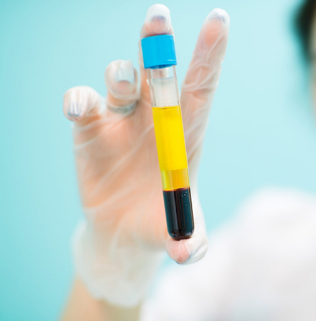 مصر تستخدم بلازما المتعافين من فيروس كورونا لعلاج المصابين