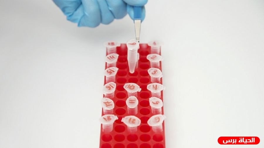 تسجيل أول إصابة بالتهاب الكبد الحاد مجهول المصدر في غزة