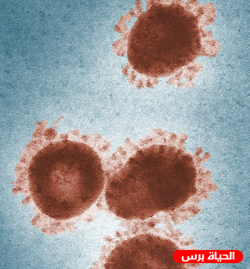 ما هو فيروس ماربورغ Marburg virus 