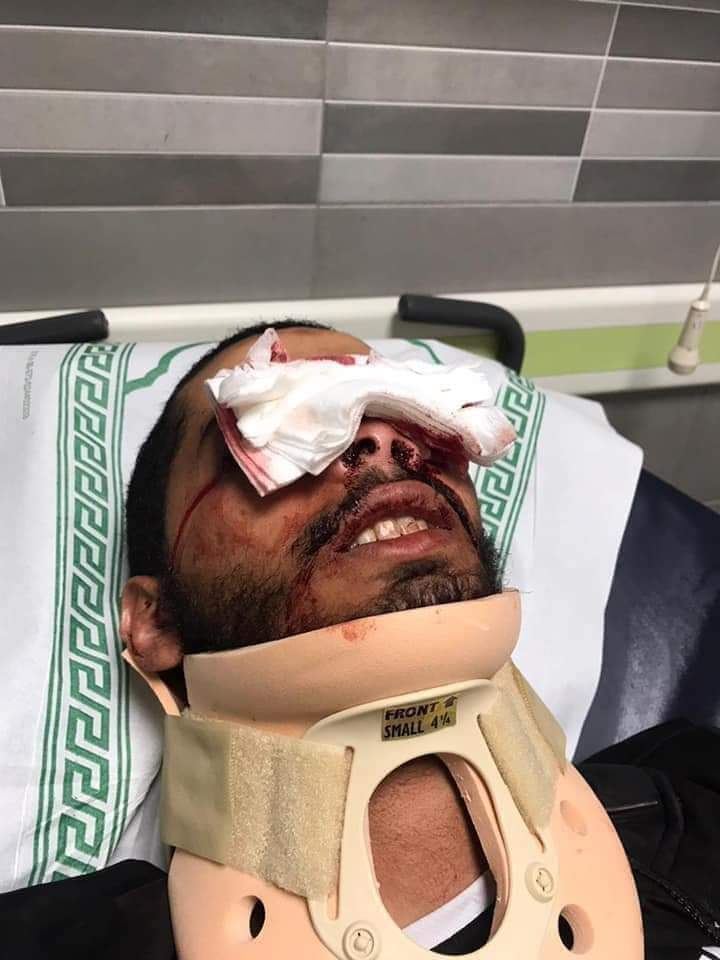 الهلال الأحمر: أكثر من 205 اصابة جراء المواجهات في القدس أغلبها بالأجزاء العلوية