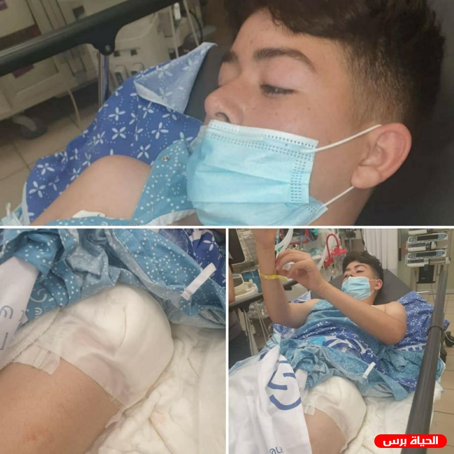 الاحتلال يقرر الإفراج عن الطفل المصاب خالد سمحان من رأس كركر