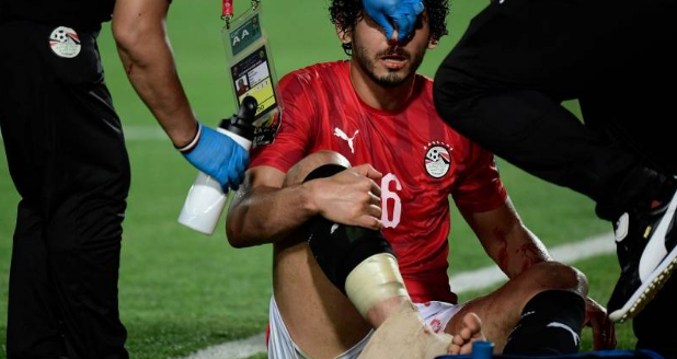 احمد حجازي يتعرض للكسر في الأنف