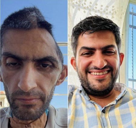 مجاهد بني مفلح .. تدهور صحي خطير يلاحق صحفيًا فلسطينيًا بعد الإفراج عنه
