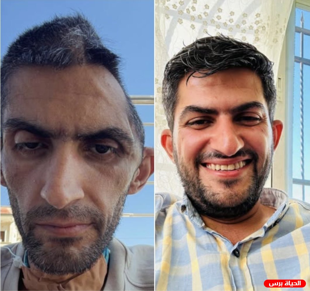 مجاهد بني مفلح .. تدهور صحي خطير يلاحق صحفيًا فلسطينيًا بعد الإفراج عنه