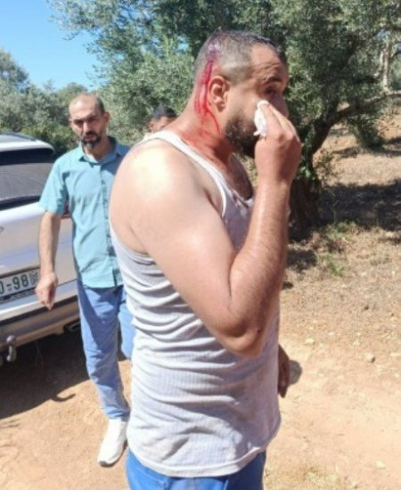 إصابة ثلاثة مواطنين باعتداء مستوطنين أثناء قطف الميرمية شرق سلفيت