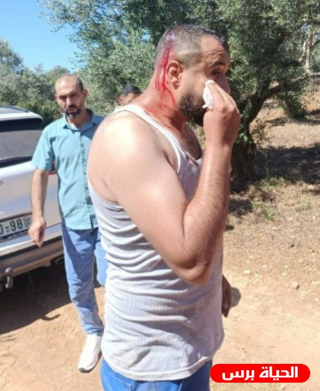 إصابة ثلاثة مواطنين باعتداء مستوطنين أثناء قطف الميرمية شرق سلفيت
