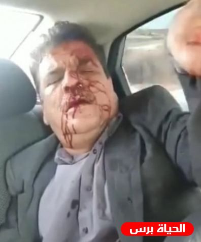 تفاصيل اصابة عضو المجلس الثوري لحركة فتح بيان الطبيب