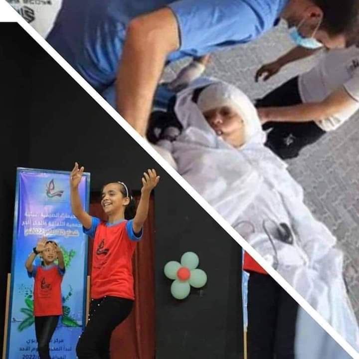 استشهاد الطفلة ليان الشاعر متأثرة بجراحها