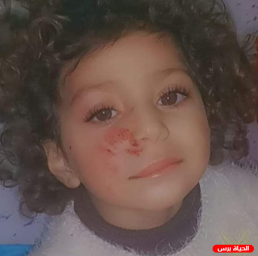 وفاة الطفلة سجى الاقرع جراء حادث سير وسط قطاع غزة 