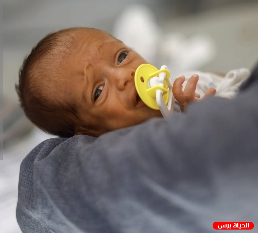أطفال غزة بين الجوع وخطر سوء التغذية المزمن.. أحدث أرقام اليونيسف تكشف صورة مقلقة