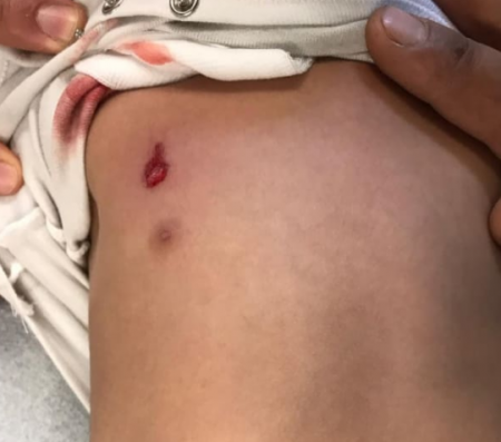 إصابة طفل بشكل مفاجئ خلال لعبه بفناء المنزل والسبب كان صادماً