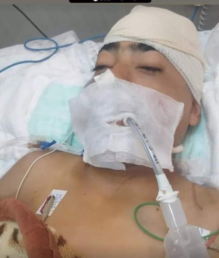 الشرطة تعتقل المتهم بالاعتداء على الطفل أحمد ابو طواحينة