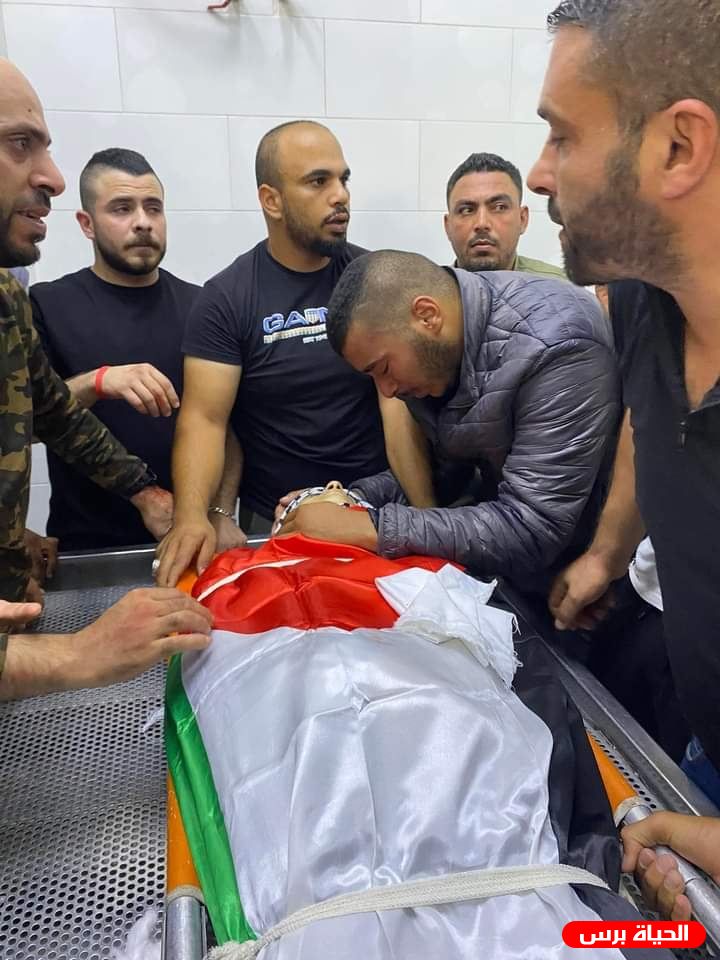 شهيد و3 إصابات إحداها خطيرة برصاص الاحتلال في كفر دان