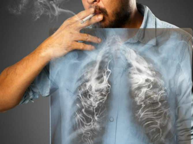 وصفات لتنظيف الصدر من آثار التدخين