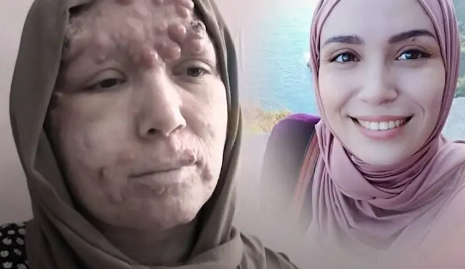 ايمان بوخالفة .. مرض نادر يهدد مستقبلها