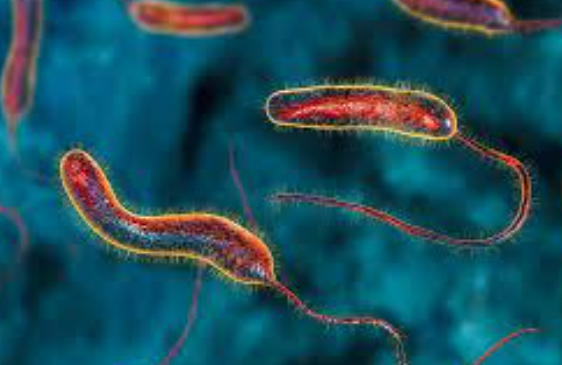 بعد تسجيل أول حالة في الخليج .. شاهد أعراض الكوليرا